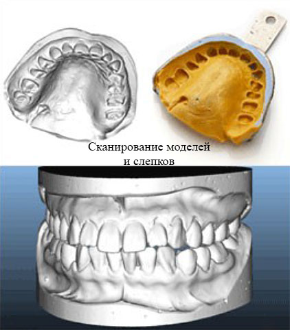 3D  Roland Medit Identica